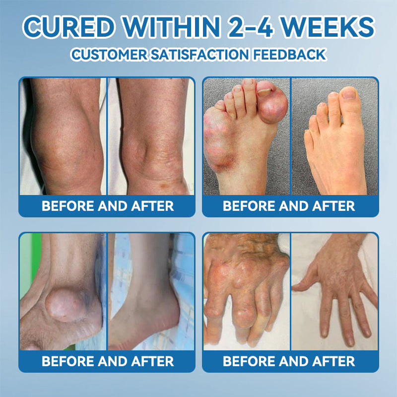 LOVILDS™𝐁𝐏𝐂-𝟏𝟓𝟕 𝐉𝐨𝐢𝐧𝐭 𝐇𝐞𝐚𝐥𝐢𝐧𝐠 𝐂𝐫𝐞𝐚𝐦🦴Treats Arthritis, Neuropathy, Rheumatism, Sports Injuries & More🏆