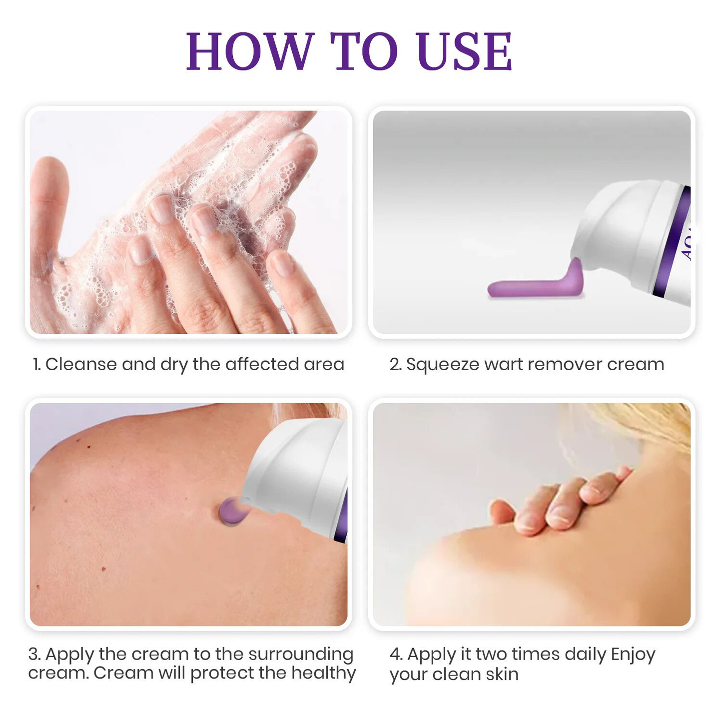 AQA® Instant Mole & Spot Cream