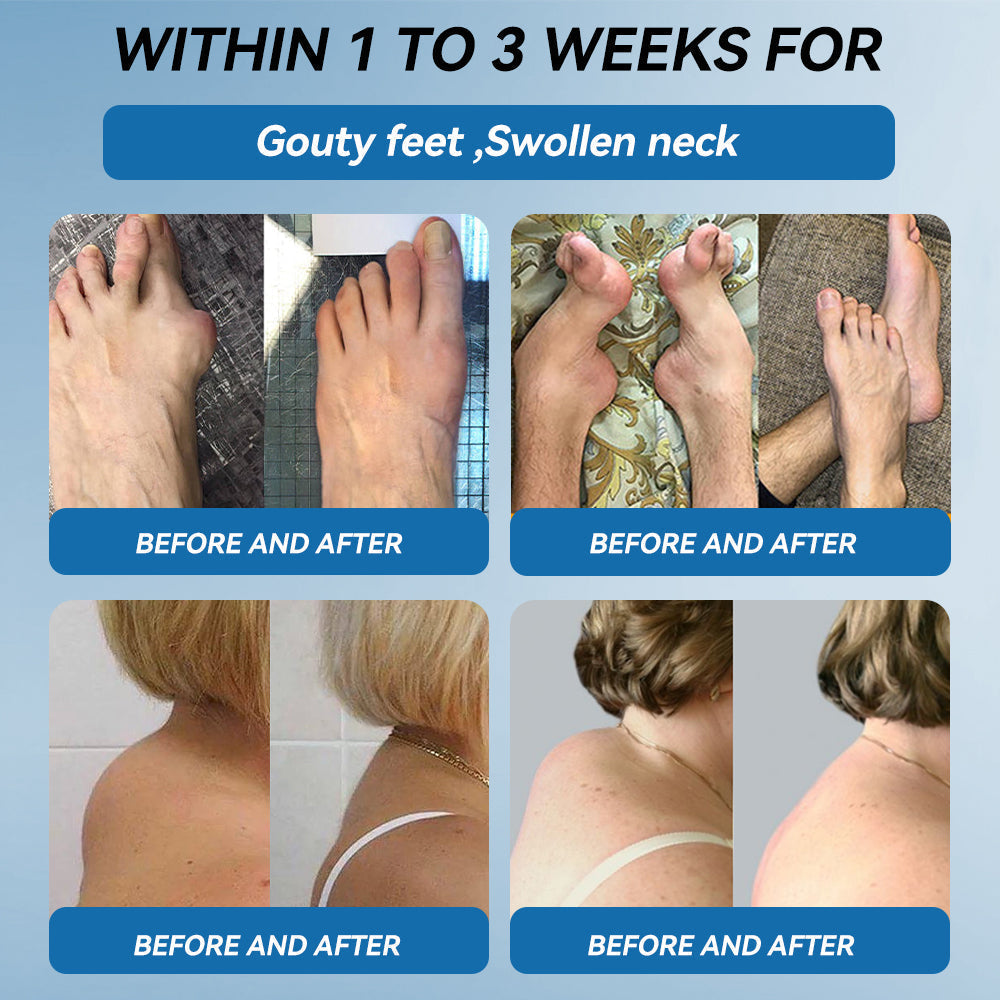 LOVILDS™𝐁𝐏𝐂-𝟏𝟓𝟕 𝐉𝐨𝐢𝐧𝐭 𝐇𝐞𝐚𝐥𝐢𝐧𝐠 𝐂𝐫𝐞𝐚𝐦🦴Treats Arthritis, Neuropathy, Rheumatism, Sports Injuries & More🏆