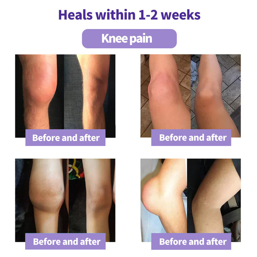 ⏰Last Day Promotion: BUY 1 GET 1 FREE🔥Lovilds™ Turmeric & Emu Oil Arthritis Soothing Pain Relief Massage Gel 👨⚕️Australian Osteopathic Association (AOA)Approved