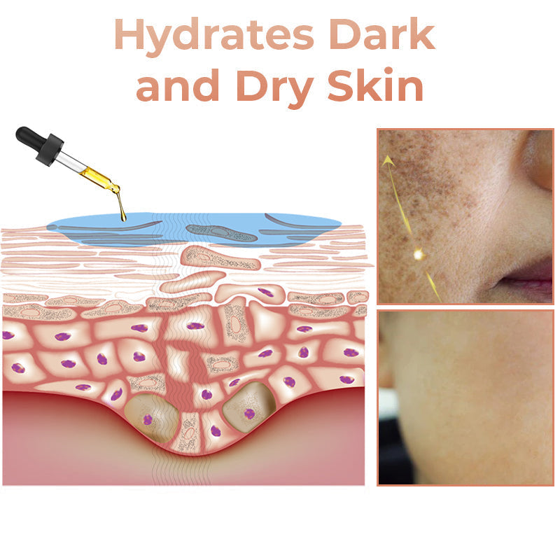 ✨Fast Dark Spot Remover-NESLEMY™  Correcting Facial Serum