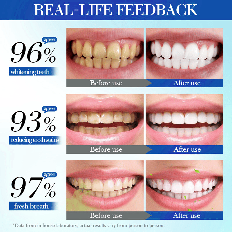 đĽHot Listing đĽLOVILDSÂŽ Toothpaste 7.5% for Enamel Repair & Teeth Whitening Refreshing Flavor Fluorid