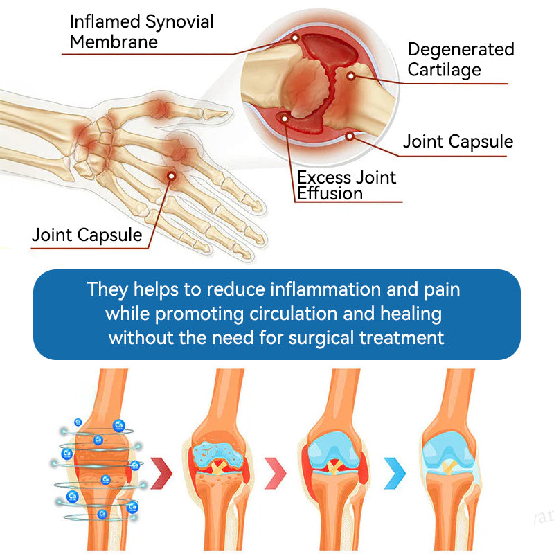 LOVILDS™𝐁𝐏𝐂-𝟏𝟓𝟕 𝐉𝐨𝐢𝐧𝐭 𝐇𝐞𝐚𝐥𝐢𝐧𝐠 𝐂𝐫𝐞𝐚𝐦🦴Treats Arthritis, Neuropathy, Rheumatism, Sports Injuries & More🏆