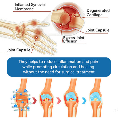 LOVILDS™𝐁𝐏𝐂-𝟏𝟓𝟕 𝐉𝐨𝐢𝐧𝐭 𝐇𝐞𝐚𝐥𝐢𝐧𝐠 𝐂𝐫𝐞𝐚𝐦🦴Treats Arthritis, Neuropathy, Rheumatism, Sports Injuries & More🏆
