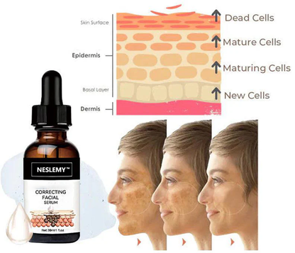 ✨Fast Dark Spot Remover-NESLEMY™  Correcting Facial Serum