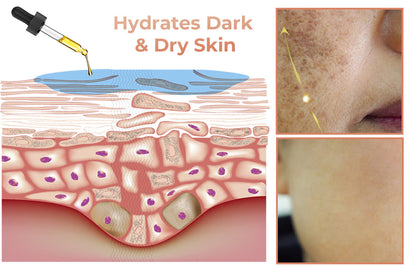 ✨Fast Dark Spot Remover-NESLEMY™  Correcting Facial Serum