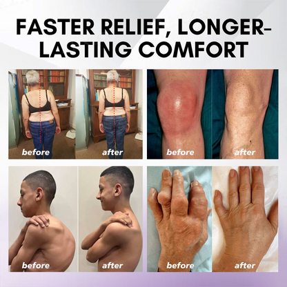 ⏰Last Day Promotion: BUY 1 GET 1 FREE🔥Lovilds™ Turmeric & Emu Oil Arthritis Soothing Pain Relief Massage Gel 👨‍⚕️Australian Osteopathic Association （AOA）Approved