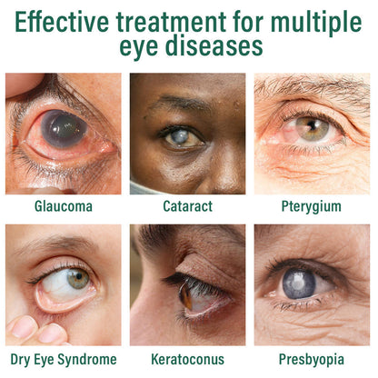 LOVILDS™ Eye Drops Serum ✅FDA Approved(Suitable for presbyopia, dry eye syndrome, glaucoma, and cataracts) 👀