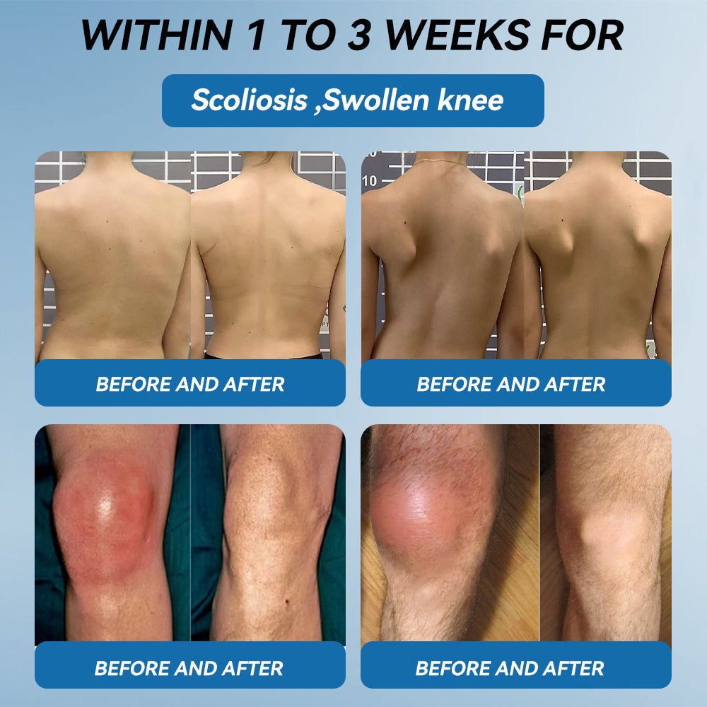 LOVILDS™𝐁𝐏𝐂-𝟏𝟓𝟕 𝐉𝐨𝐢𝐧𝐭 𝐇𝐞𝐚𝐥𝐢𝐧𝐠 𝐂𝐫𝐞𝐚𝐦🦴Treats Arthritis, Neuropathy, Rheumatism, Sports Injuries & More🏆