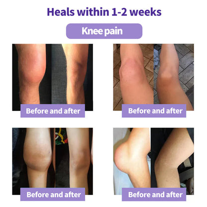 ⏰Last Day Promotion: BUY 1 GET 1 FREE🔥Lovilds™ Turmeric & Emu Oil Arthritis Soothing Pain Relief Massage Gel 👨‍⚕️Australian Osteopathic Association （AOA）Approved