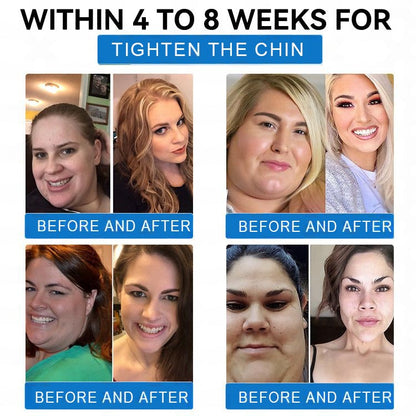 【Last Day Promotion 80% OFF🌟】🎃🎃LOVILDS™ SMGT-GLP-1 𝐓𝐢𝐫𝐳𝐞𝐩𝐚𝐭𝐢𝐝𝐞 & 𝐂𝐨𝐥𝐥𝐚𝐠𝐞𝐧 𝐍𝐚𝐧𝐨 𝐌𝐢𝐜𝐫𝐨𝐧𝐞𝐞𝐝𝐥𝐞 𝐖𝐞𝐢𝐠𝐡𝐭 𝐋𝐨𝐬𝐬 𝐏𝐚𝐭𝐜𝐡丨Targets Obesity, Loose Skin, High Blood Pressure, Diabetes, Fatty Liver, Joint Pain, Brain Fog, Low Energy, Body Aches, and More