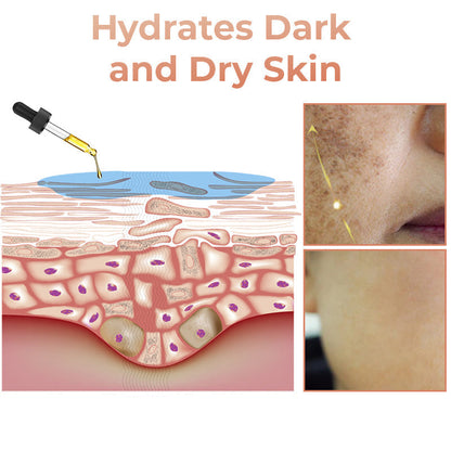 ✨Fast Dark Spot Remover-NESLEMY™  Correcting Facial Serum