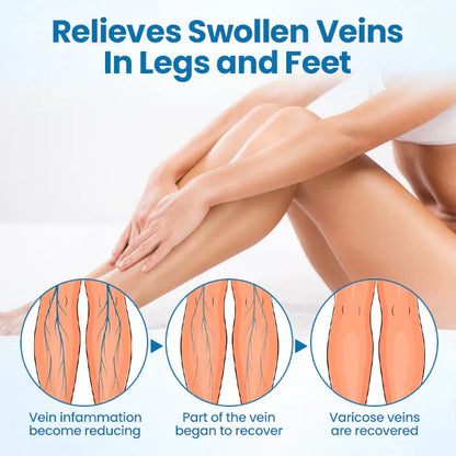 Lovilds® VeinPure Herbal Spray-✅ Clinically proven to eliminate varicose veins in just 7 days!