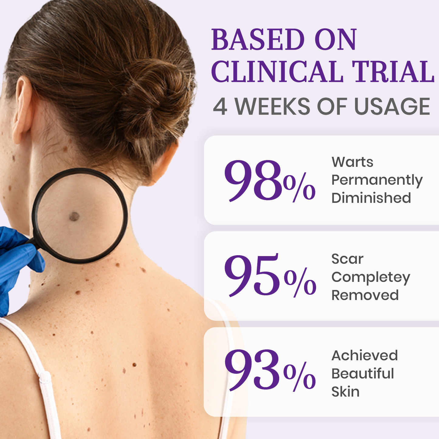 AQA® Instant Mole & Spot Cream