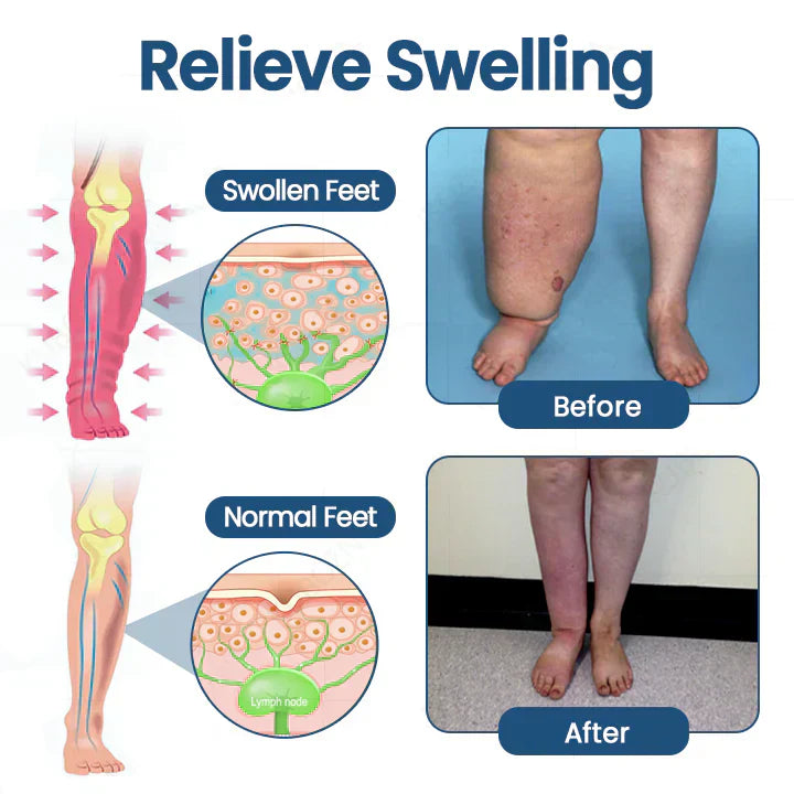 Alisanda® LYMPHEDEMA ROLL-ON RELIEF CREAM