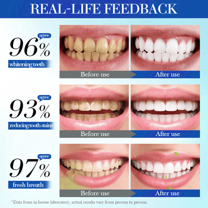 💥Hot Listing 🔥LOVILDS® Toothpaste 7.5% for Enamel Repair & Teeth Whitening Refreshing Flavor Fluorid